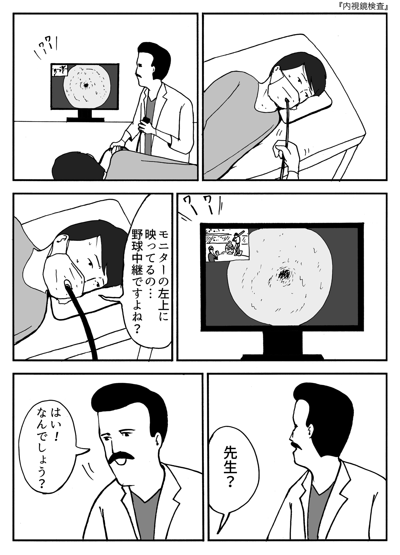 内視鏡検査